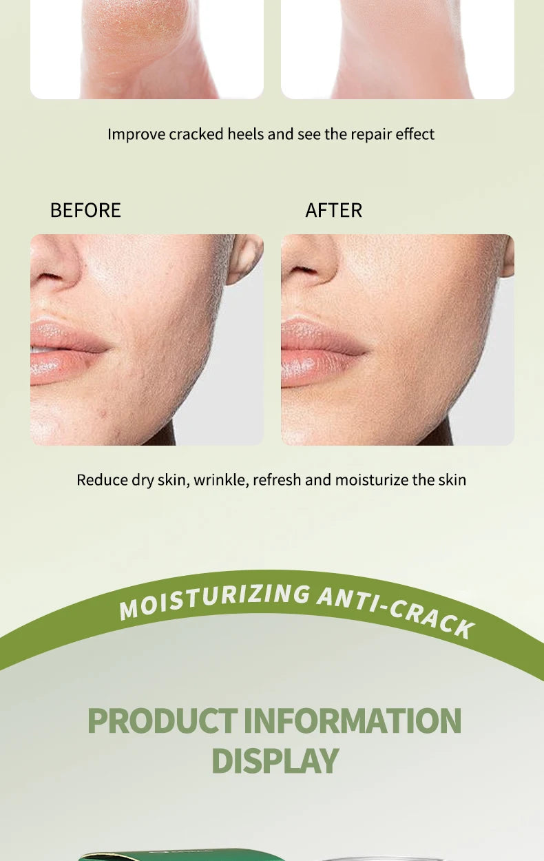 O’CHEAL 40g Foot Skin Care Cream Stick Nourishing Cream Hand Facial Cream Removal Dead Skin Moisturizing Hand Feet Gel Skin Care