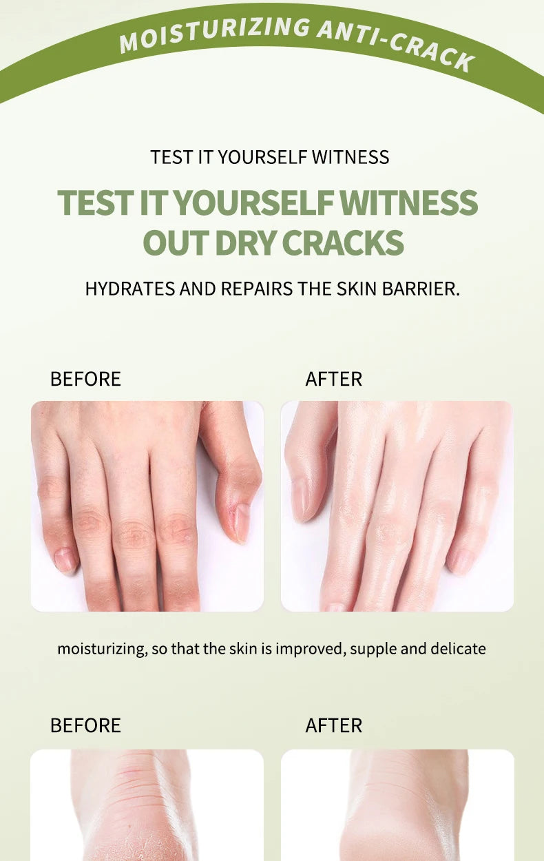 O’CHEAL 40g Foot Skin Care Cream Stick Nourishing Cream Hand Facial Cream Removal Dead Skin Moisturizing Hand Feet Gel Skin Care