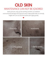 Freckle Remove Cream Whiten Face Cream Firming Moisturizing Anti-wrinkle Spot-removing Facial Cream Beauty Skin Care Serum