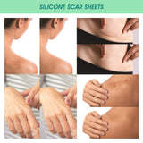 Scar Patches Remove Silicone Gel Sheet Correctors Burn Wounds Efficient Surgery Scar Tape Skin Repair Self-Adhesive Scar Cover