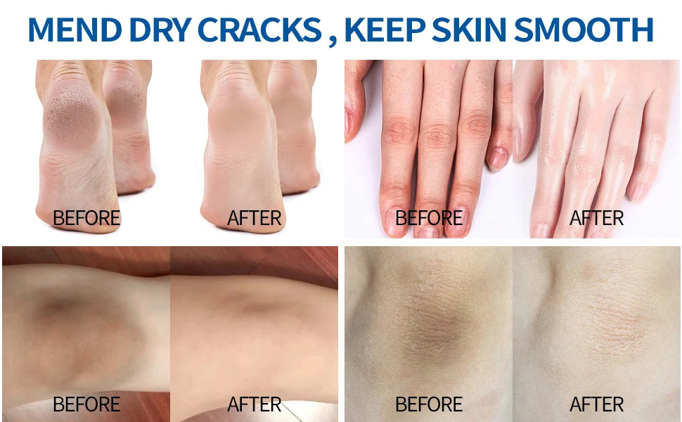 60% Urea Foot Cream Stick with 2% Salicylic Acid, Foot Care Cream Moisturizer for Dry Cracked Feet, Knees, Hands, Moisturizes Skin