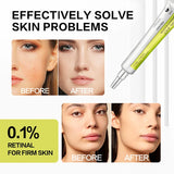 Korean Retinol Moisturizing Essence Anti-aging Lighten Dark Circles Wrinkles Eye Cream Firming Brighten Skin Vitamin C Essence