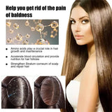 Fast Anti Exfoliating Scrub Remove Dandruff Anti Itching Treatment Seborrheic Scalp Oil Control Repair Scalp Beauty Health Care