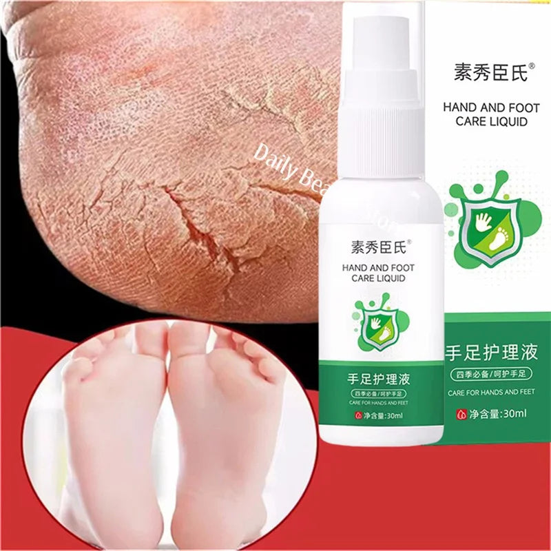 Herbal Anti Crack Foot Cream Spray Heel Cracking Repair Products Exfoliation Dead Skin Removal Softening Moisturize Smooth Care