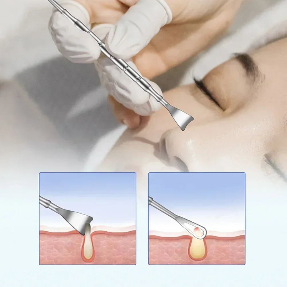 Blackhead Remover Pimple Popper Tool Acne Needle Removing Treatment Comedone Whitehead Popping Zit Nose Face Blemish Extractor