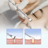 Blackhead Remover Pimple Popper Tool Acne Needle Removing Treatment Comedone Whitehead Popping Zit Nose Face Blemish Extractor