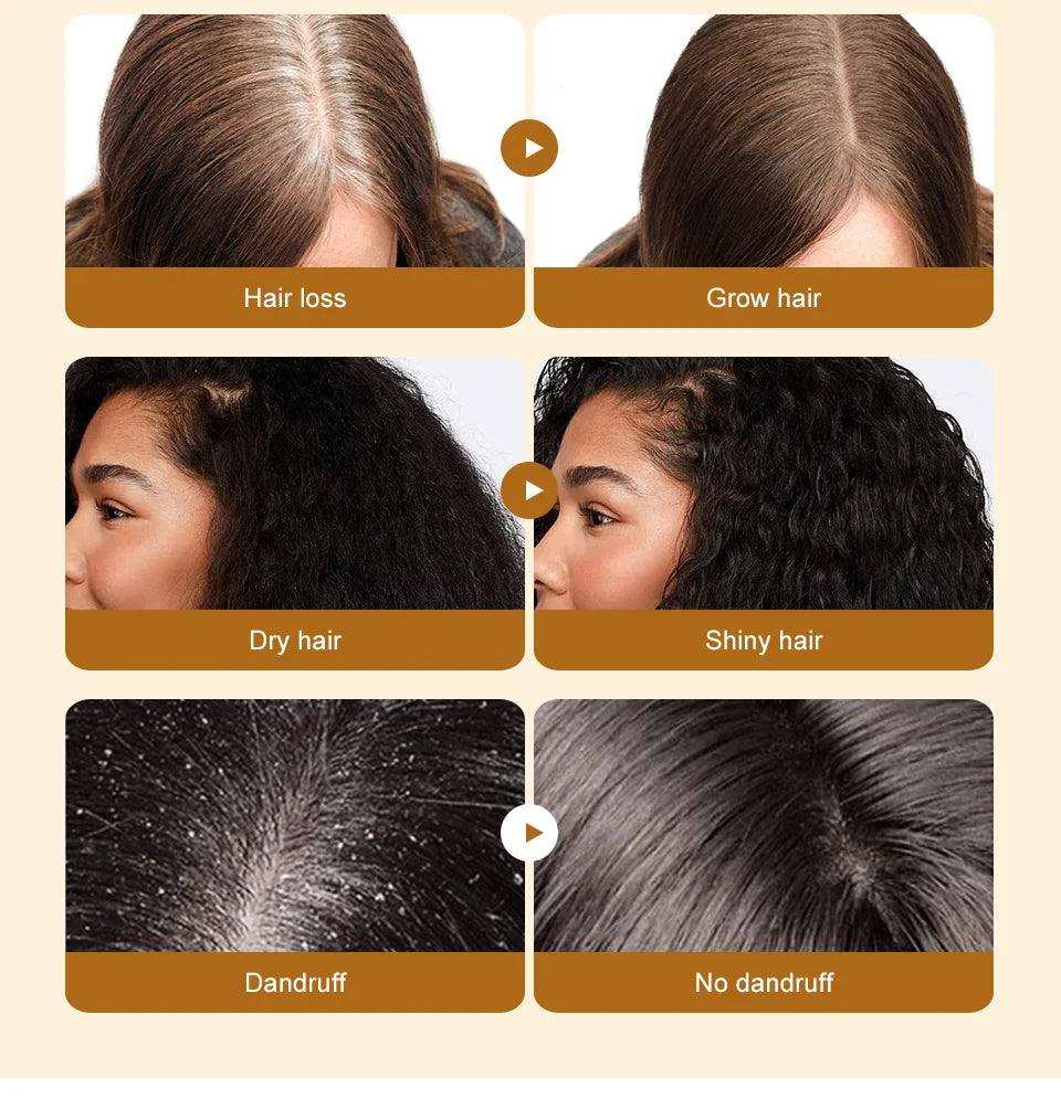Hair Growth Batana Oil Serum Fast Growing Hair Essential Oil Beauty Hair Care Anti-Hair Loss Essence Natural Repair Damaged Hair