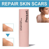 60% Silicone Silicone Scar Stick Velvety Film Centella Asiatica Extracts Scar Treatment Stick Soothing Formula Vitamin E Infused