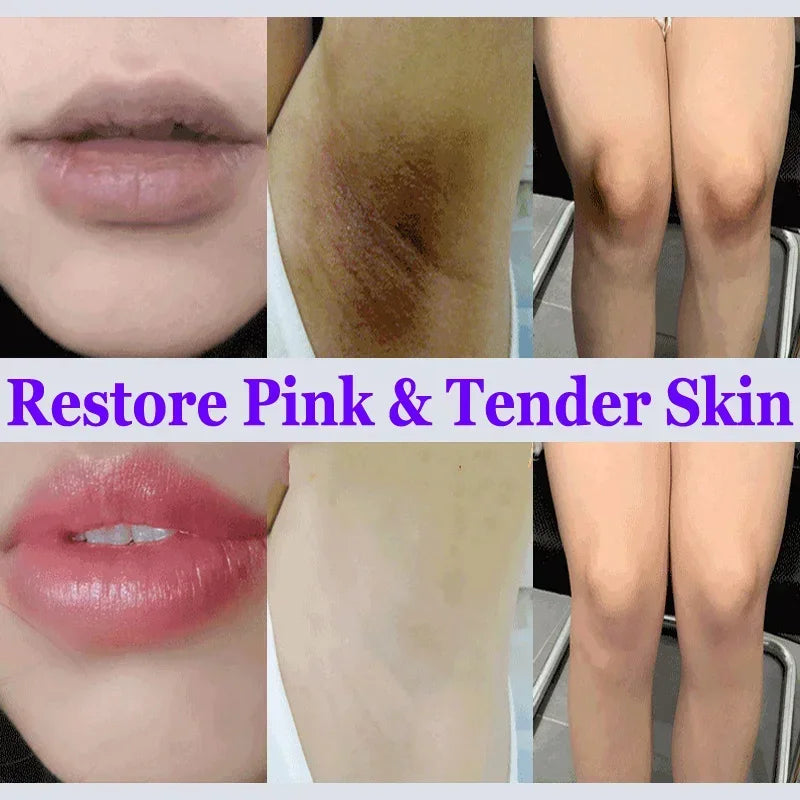 Niacinamide Whitening Cream Stick Remove Dark Spots Bleaching Private Parts Underarm  Brighten Butt Knee Inner Thigh Body Care