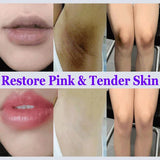 Niacinamide Whitening Cream Stick Remove Dark Spots Bleaching Private Parts Underarm  Brighten Butt Knee Inner Thigh Body Care