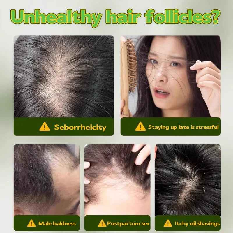 Usman Grass & Platycladus Herbal Shampoo Soap Natural Hair Loss Treat Strengthens Roots Controls Oil Cleanses Scalp Hair Growth