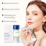 Salicylic Acid Serum for Acne Drying Lotion Acne Treatment Sensitive Skin Care Pimples Acne Remover Serum Cream Anti Acne Serum