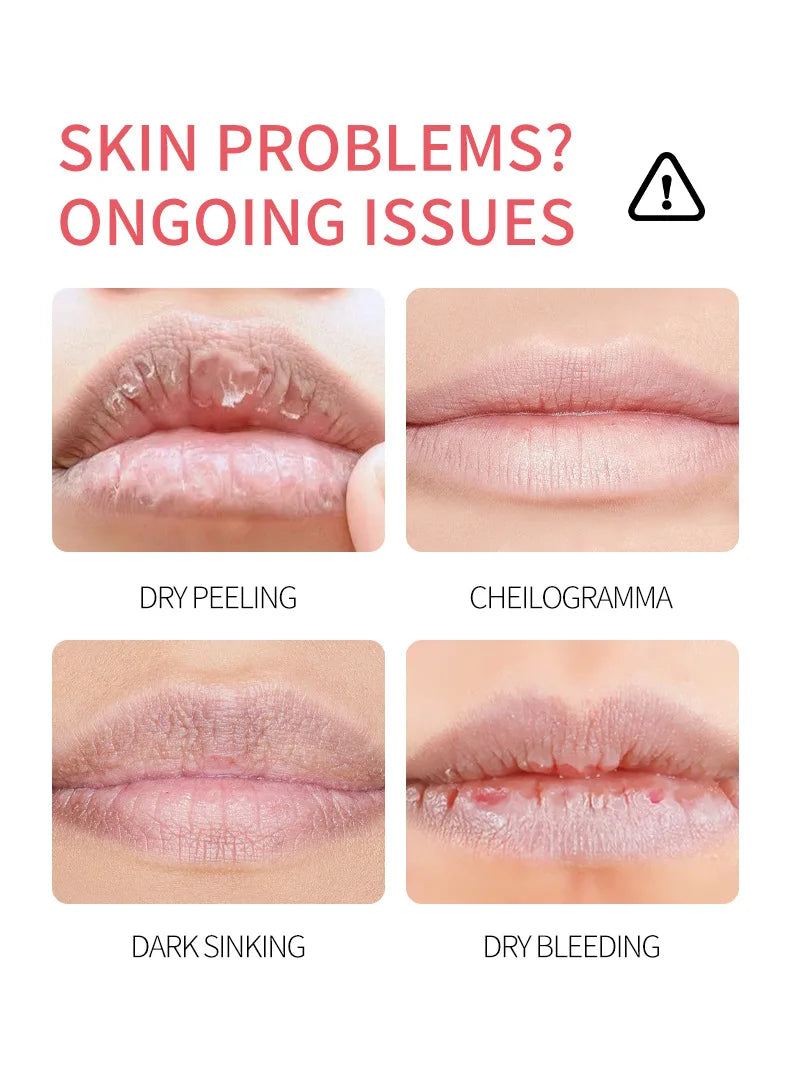 8 Pieces Vaseline Lip Balm Set Rose Lemon Flavor Moisturizing Anti-Dry Crack Long Lasting Nourishing Lip Mask Lip Care
