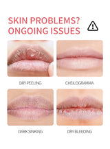 8 Pieces Vaseline Lip Balm Set Rose Lemon Flavor Moisturizing Anti-Dry Crack Long Lasting Nourishing Lip Mask Lip Care