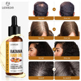 Hair Growth Batana Oil Serum Fast Growing Hair Essential Oil Beauty Hair Care Anti-Hair Loss Essence Natural Repair Damaged Hair