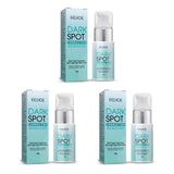 Freckle Whitening Cream Nicotinamide Fade Dark Spot Blemish Acne Mark Brightening Lightening Pigmentation Correction Cream