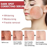 Powerful Dark Spots Remover Whitening Serum Face Freckle Melanin Correcting Anti Pigmentation Brighten Skin Beauty Care Essence