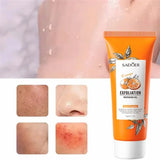 Orange Exfoliating Peeling Gel Facial Scrub Moisturizing Nourish Repair Scrubs Blackhead Removal Face Cleanser Korean Cosmetics