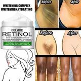 Body Whitening Cream Dark Skin Armpit Lightening Intimate Areas Underarm Bleaching Private Parts Whiten Cream Body Lotion Beauty