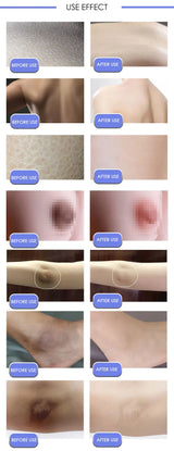 Body Whitening Cream Private Parts Underarm Bleaching Serum Whiten Butt Knee Brighten Inner Thigh Intimate Dark Remove Melanin