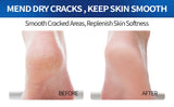 60% Urea Foot Cream Stick with 2% Salicylic Acid, Foot Care Cream Moisturizer for Dry Cracked Feet, Knees, Hands, Moisturizes Skin