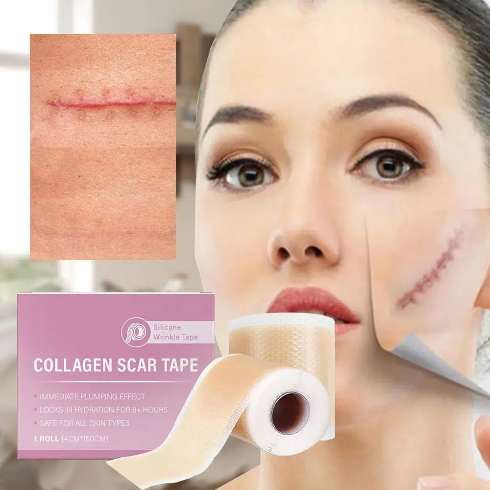 1 Roll Silicone Scar Sheets , 4cmX150cm Self-Adhesive Scar Cover Tape Reusable and Effective Skin Care Strips collagen scar tape