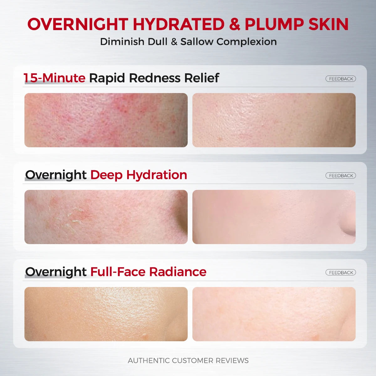 After-Sun Cooling Gel Cream – Soothing Hydration Moisturizer with Probiotics + Ceramide, Oil-Balancing Care
