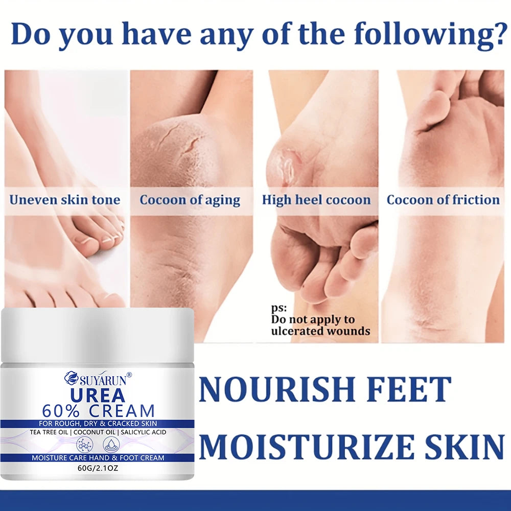 SUYARUN 60% Urea Foot Cream for Cracked Heels & Dry Skin - Intensive Moisturizing Treatment, Callus Remover, Diabetic Foot Care.