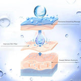 Belly Silicone Pad Anti Wrinkle Scar Stretch Marks Removal Sheets Reusable for Women Abdomen Belly Stomach Pads Body Care Tools