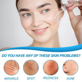 B5 Hyaluronic Acid Serum Facial Anti A-ging W-rinkle Lift Firming Fine Lines Lightening Dark Circle Skin Brightening Hyalu Serum