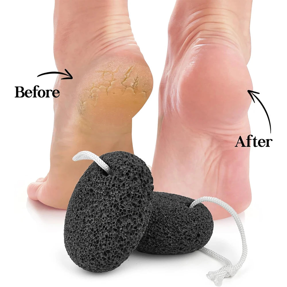 Natural Lava Pumice Stone Callus Remover for Feet Heels and Palm Clean Scruber Hard Skin Callus Remover Scrub Pumice Tool