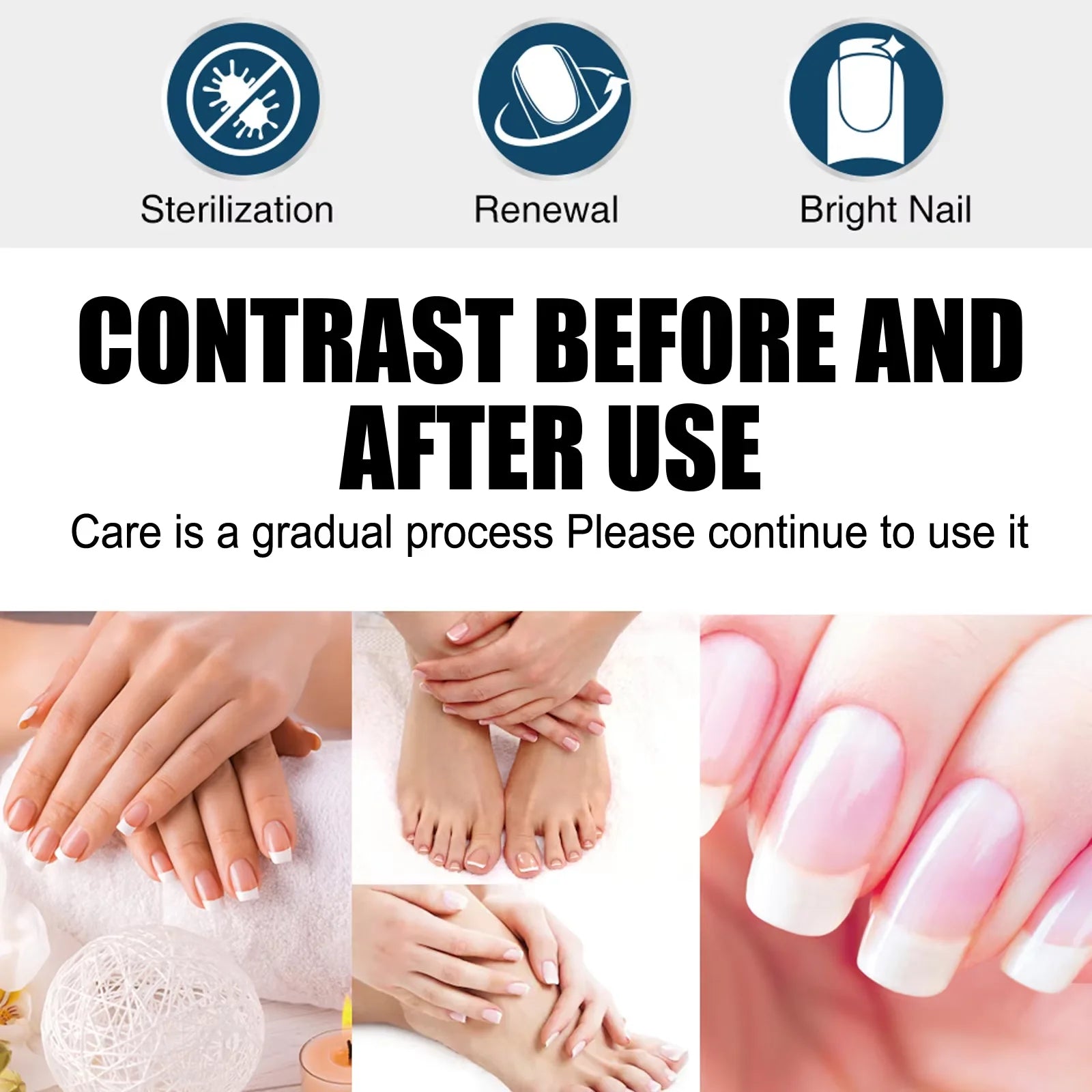 South Moon Nail Fungus Repair Pen Remove Onychomycosis Paronychia Reduce Toe Infection Brighten Nail Hand Foot Nail Care Liquid