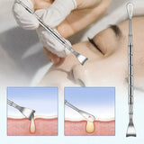 Blackhead Remover Pimple Popper Tool Acne Needle Removing Treatment Comedone Whitehead Popping Zit Nose Face Blemish Extractor