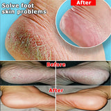 Herbal Anti Crack Foot Cream Spray Heel Cracking Repair Products Exfoliation Dead Skin Removal Softening Moisturize Smooth Care