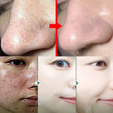 Original Facial Remove Blackhead Green Tea Solid Mask Treat Acne Blemish Black Dots Clean Stick Cream Shrink Pores Skin Care  ﻿