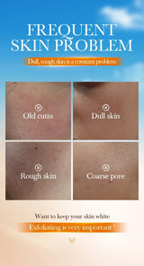 Orange Exfoliating Peeling Gel Facial Scrub Moisturizing Nourish Repair Scrubs Blackhead Removal Face Cleanser Korean Cosmetics