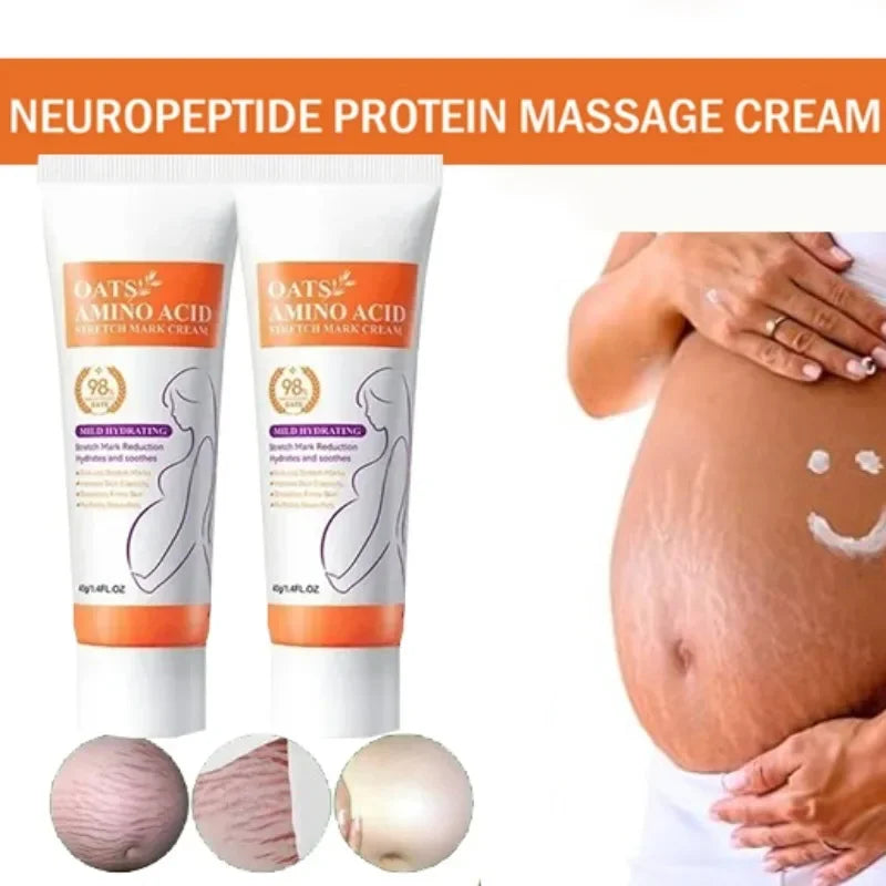 Stretch Marks Permanent Removal Cream Eliminate Body Belly Stretch Marks Swelling Marks Remove Skin Cracks Repair Firming Care