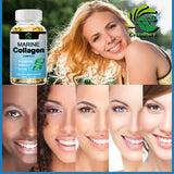 Greensure Marine Collagen - With Hyaluronic Acid, Biotin & Blueberry Support Joint, Hair, Skin, Nail, Cartilage & Overall Health