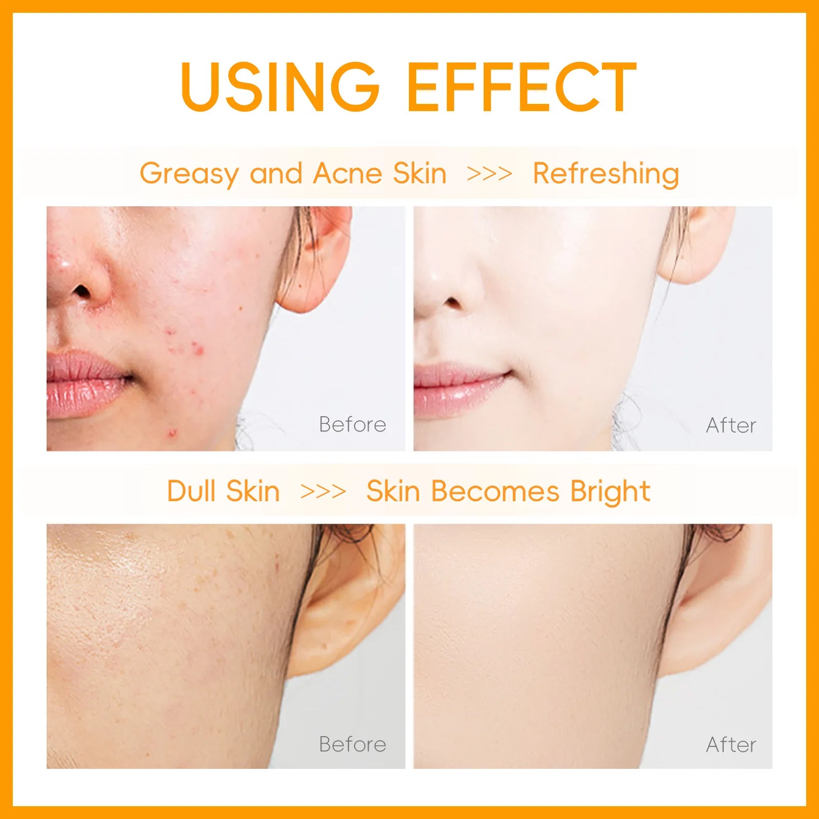 Vitamin C Facial Cleanser Deep Cleansing Moisturizing Blackhead Removal Gentle Foam Hydrating Non-Drying Face Wash Cleanser