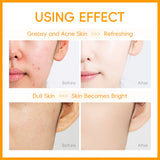 Vitamin C Facial Cleanser Deep Cleansing Moisturizing Blackhead Removal Gentle Foam Hydrating Non-Drying Face Wash Cleanser