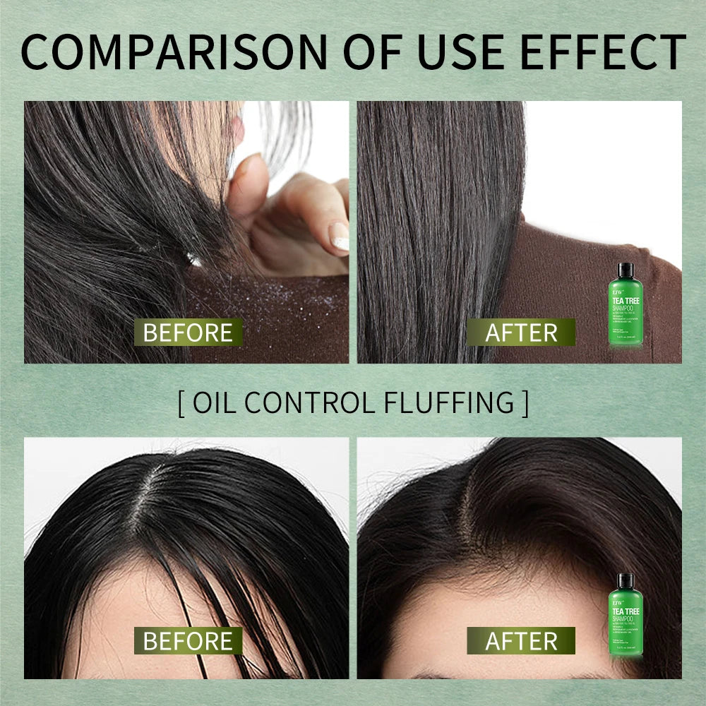 Tea Tree Shampoo Soothes Dry Scalp Controls Oil Moisturizes Hair Restores Natural Shine Sulfate Paraben Free For All Hair Types