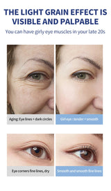 OCHEAL Electric Massage Eye Cream Hyaluronic Acid Firming Fades Fine Lines Eye Care Gel Moisturizing Beauty Eye Skin Care Beauty