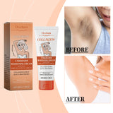 Underarm Whitening Cream Armpit Legs Knee Elbow Cream Remove Dark Spots Melanin Brighten Skin Care Moisturizing Skin Cream 50g