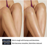 Lakerain Exfoliating Body Stick Multiple Glycolic Acid Cleaning Long-lasting Moisturizing Nourishing Smoothing Skin Care