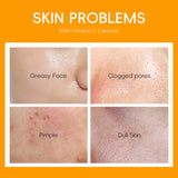 Vitamin C Facial Cleanser Deep Cleansing Moisturizing Blackhead Removal Gentle Foam Hydrating Non-Drying Face Wash Cleanser
