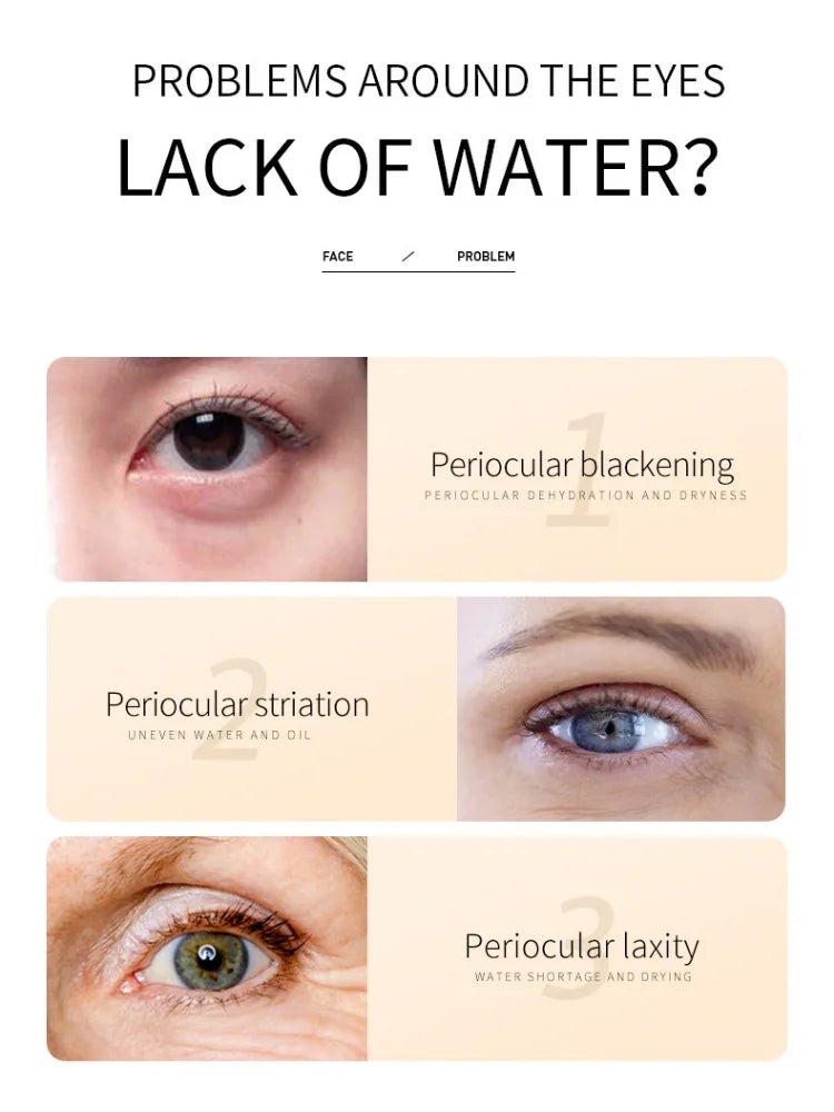 BIOAOUA Rice Whitening Eye Cream Moisturizing Reduce Dark Circles Lift Firm Brightening 20g