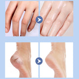 Dry and cracked heels, anti-crack cream, hand and foot hydration, moisturizing and moisturizing cream.