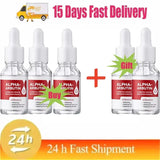 Powerful Dark Spots Remover Whitening Serum Face Freckle Melanin Correcting Anti Pigmentation Brighten Skin Beauty Care Essence