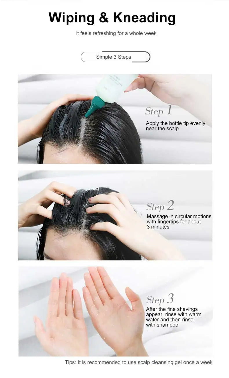 Zhangguang 101 Scalp Cleansing Gel Shampoo, Deep Hair Follicle Cleansing Liquid, Exfoliating, Oil Control, and Itching Relief Mi