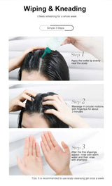 Zhangguang 101 Scalp Cleansing Gel Shampoo, Deep Hair Follicle Cleansing Liquid, Exfoliating, Oil Control, and Itching Relief Mi